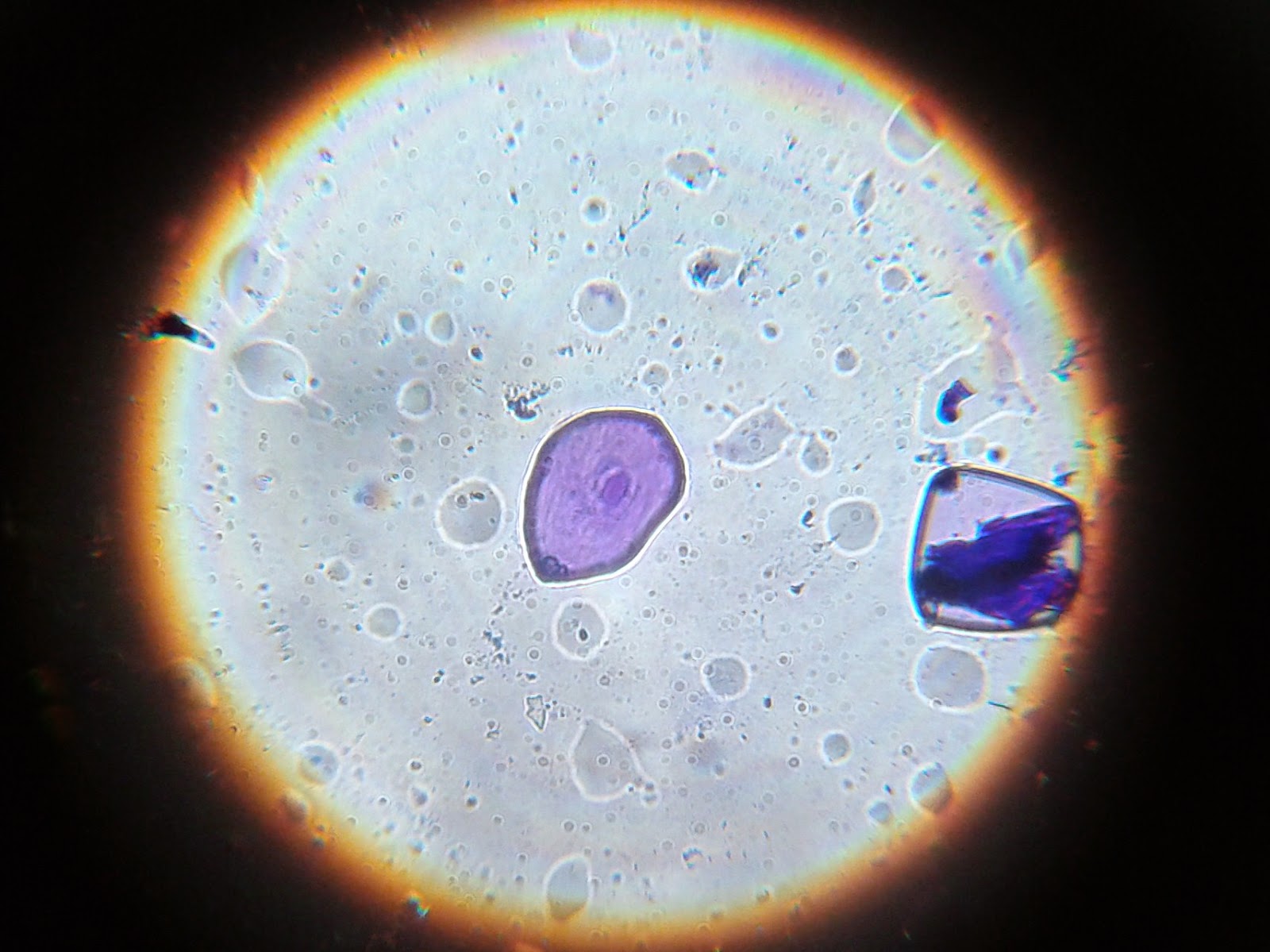 LE MICROSCOPE DU COLLÈGE WEILER (et la loupe monoculaire) OBSERVATIONS