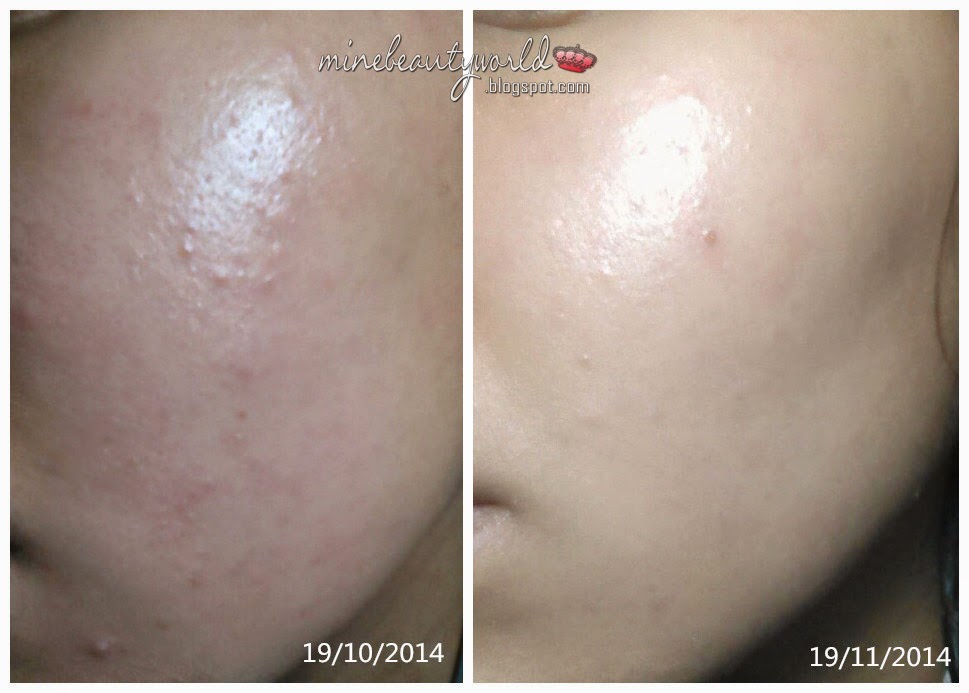 [Review] Paula's Choice Skin Perfecting 2 BHA Liquid Exfoliant Thuốc