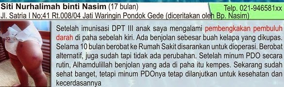 12. Umur 17 Bulan: Pembengkakan Pembuluh Darah