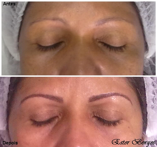 Micropigmentação de sobrancelhas antes e depois S