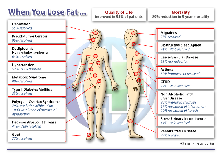 obesity health risks essay obesity health risks essay