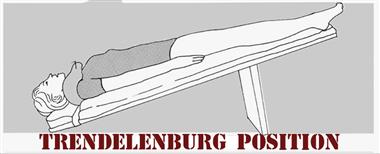 Trendelenberg-Position.jpg