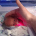 Né à 28 semaines, ce bébé est placé dans un sac en plastique, ça lui a sauvé la vie!