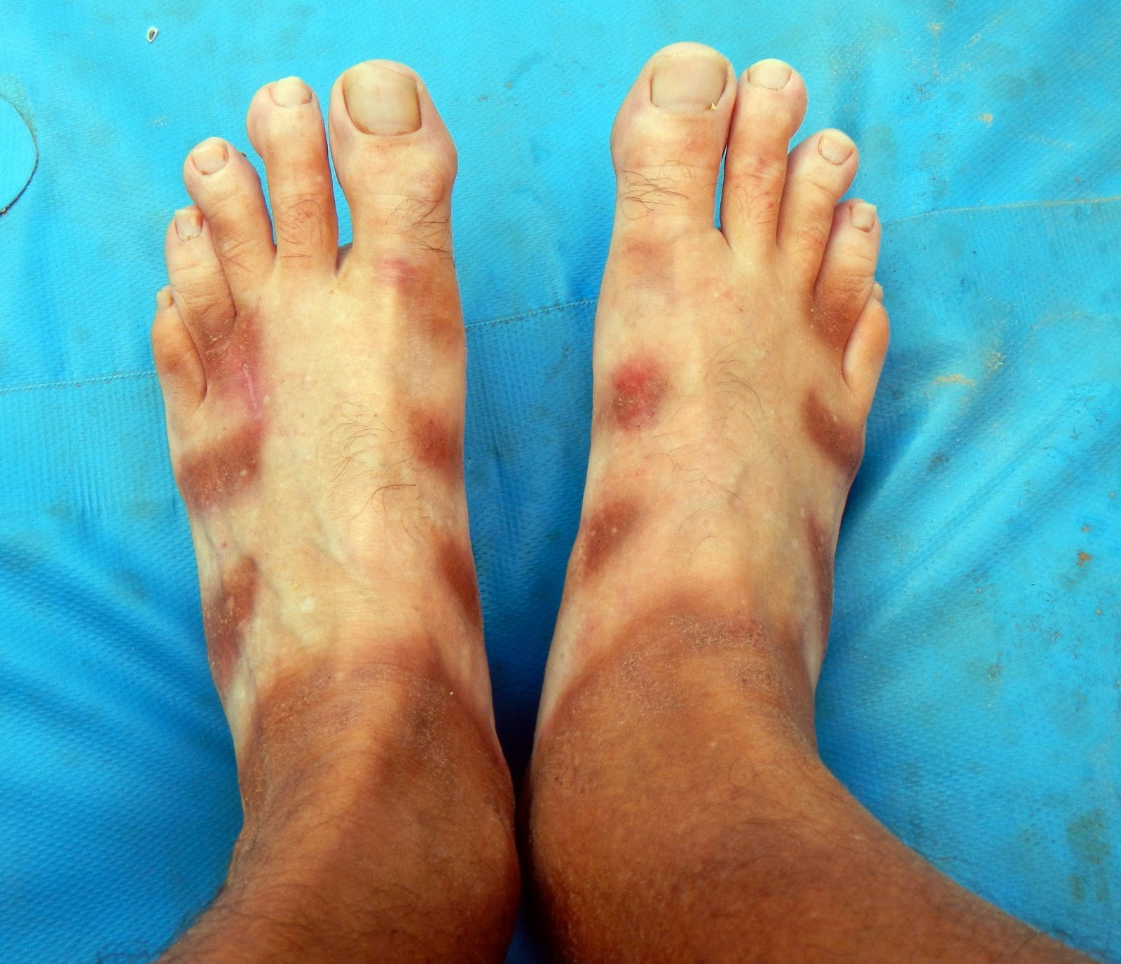 keen feet