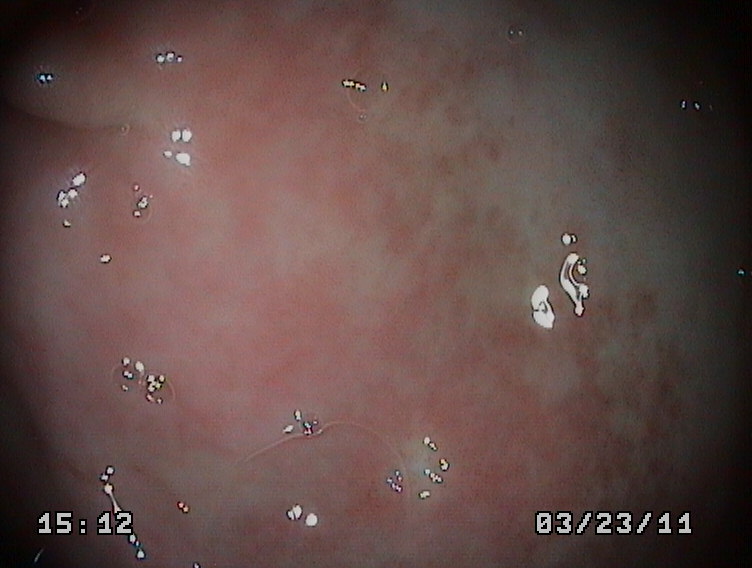 GASTROSCOPIA CANINA. GASTRITIS. CANINE GASTROSCOPY Cirugía endoscopia