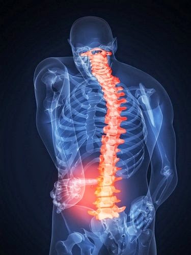 Cách chữa trị và phòng ngừa bệnh đau lưng
