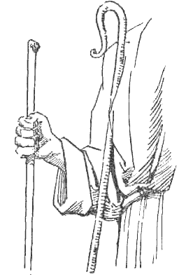 What Are A Rod And Staff