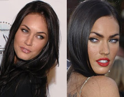 Megan Fox plastic surgery