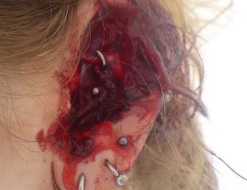 2019 year - How to Treat Infected Piercings 2019 year