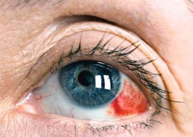 sorunuzun cevabi blogger