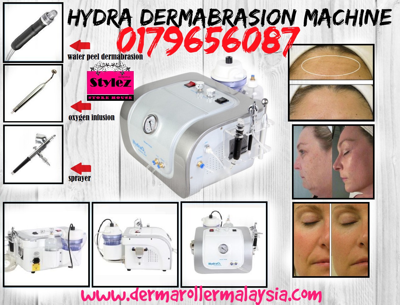 HYDRA DERMABRASION MACHINE