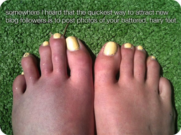 Curled Up Toes Shoes Curled Up Toes Shoes