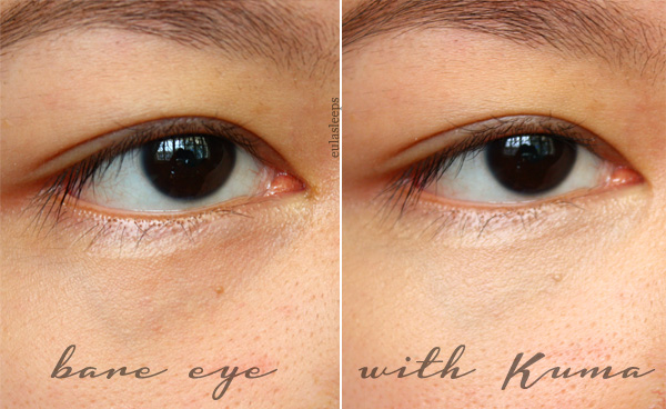 Dark Spots Cheeks Like Fingerprints For Cats Dark Spots Cheeks Like Fingerprints For Cats