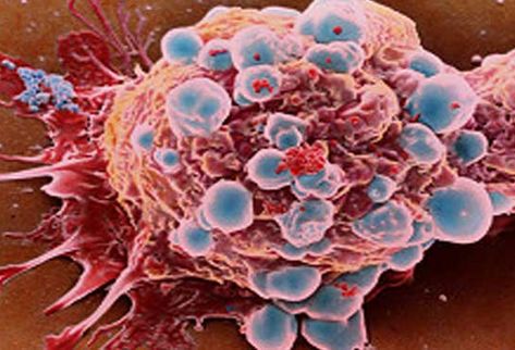Encuentran molécula que hace morir las células del cáncer Celula+cancerosa
