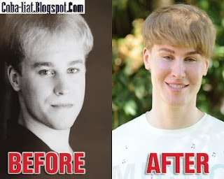 Pria Ini Rela Habiskan Rp 1 M Demi Mirip Justin Bieber Pria Ini Rela Habiskan Rp 1 M Demi Mirip Justin Bieber