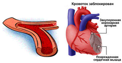 Картофель для удаления родинок