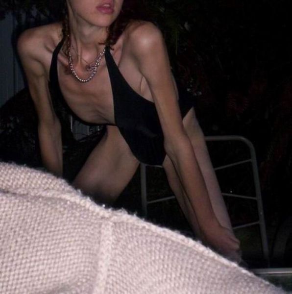 Are not Sexy anorexic women naked pics right! Topic agree Sexy anorexic women naked pics apologise, but