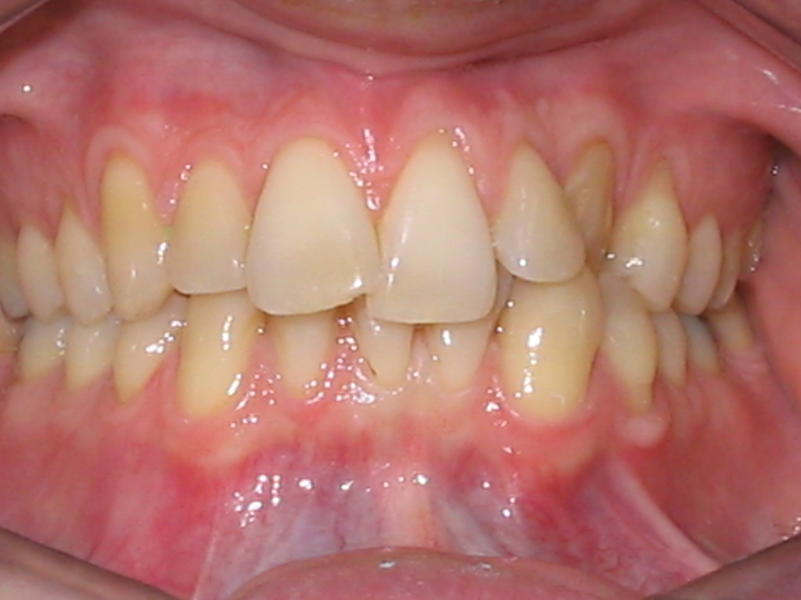 Ramin Mehregan D.M.D. HOW YOUR SMILE CHANGES WITH AGE