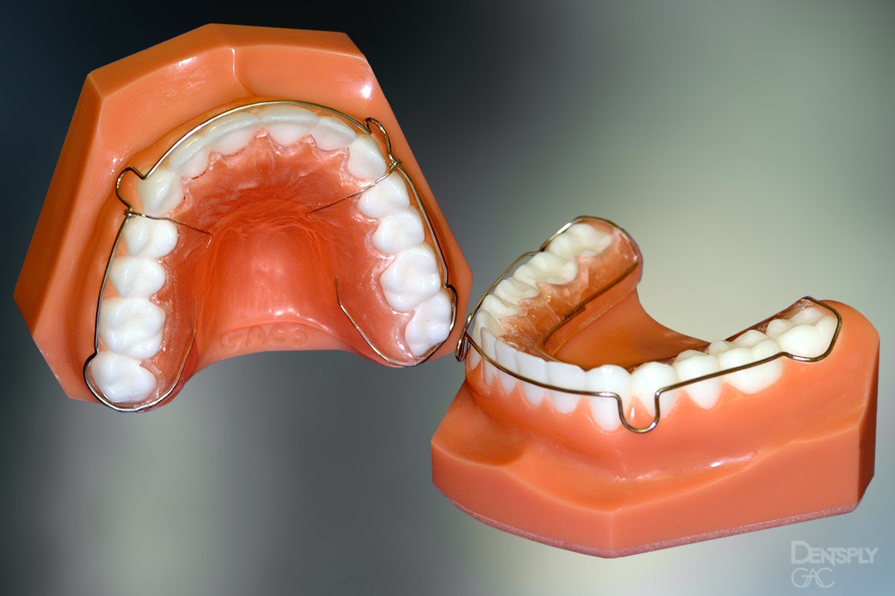 removable retainer