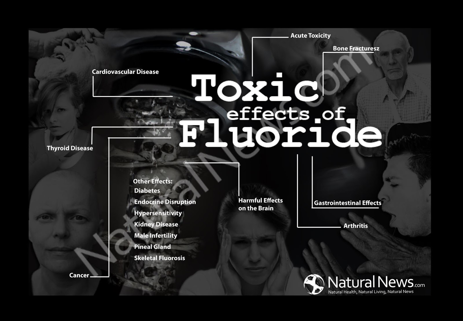 MessiahMews Blogs Toxic effects of Fluoride