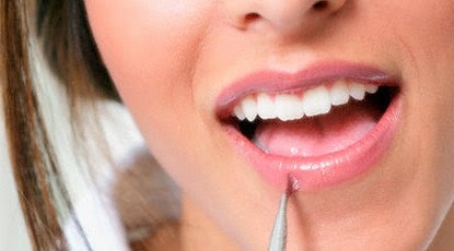Tips Wanita, Kebiasaan Kecil Penyebab Bibir Gampang Kering Tips Wanita, Kebiasaan Kecil Penyebab Bibir Gampang Kering