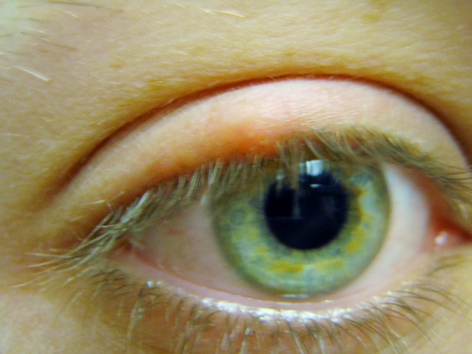 The Juicy Beauty Word Help for puffy eyelids