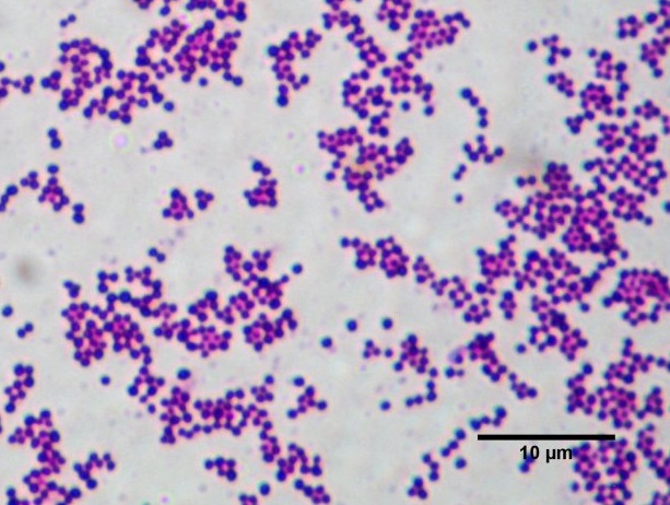 Staphylococcus aureus septicemia