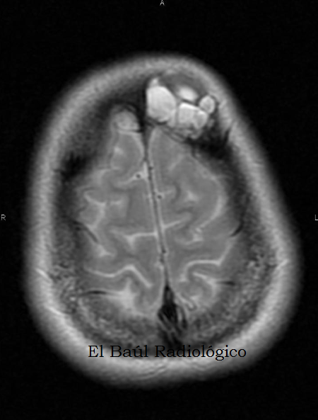 mri con contraste de la cabeza mri con contraste de la cabeza