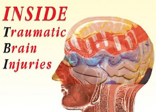 traumatic brain injury side effects