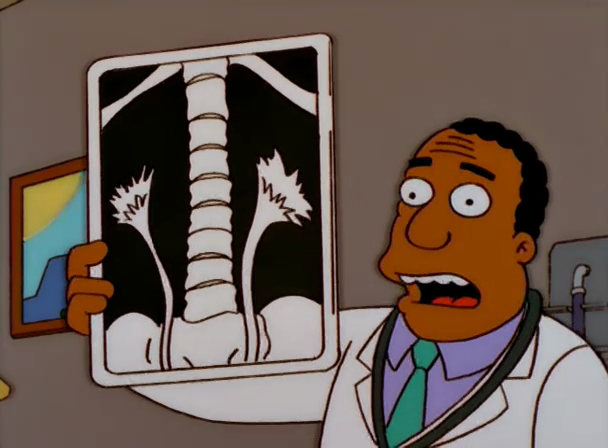 Dr.-Hibbert-Holding-Kidney-X-Ray.png