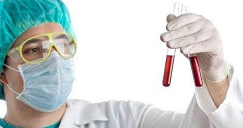 Tipo de exames de sangue
