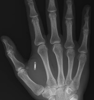 http://2.bp.blogspot.com/-sI0364y4PJM/UQravIsYehI/AAAAAAAAAd0/Tmm6KFZ3t9M/s1600/rfid_in_hand.jpg
