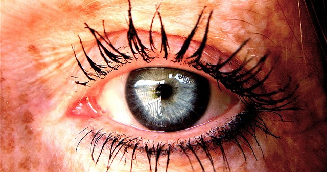 Penyebab Kekurangan Pigmen Pada Kulit | OBAT PENYAKIT KEKURANGAN PIGMEN