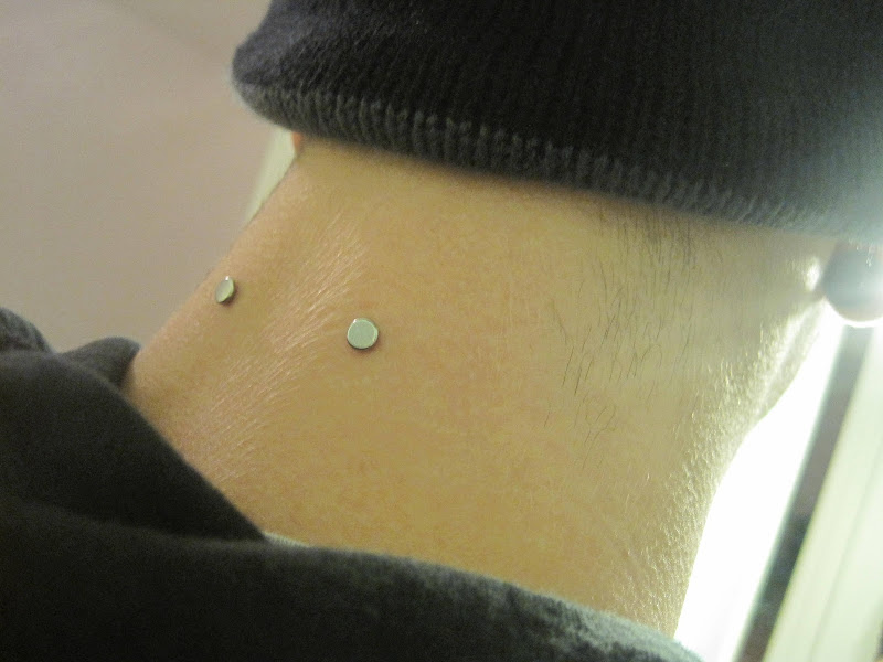 pair of micro-dermals on the nape of a fellow Redditor. I think it title=