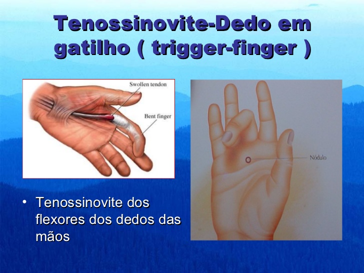 Tratamento de dores e doenças articulares