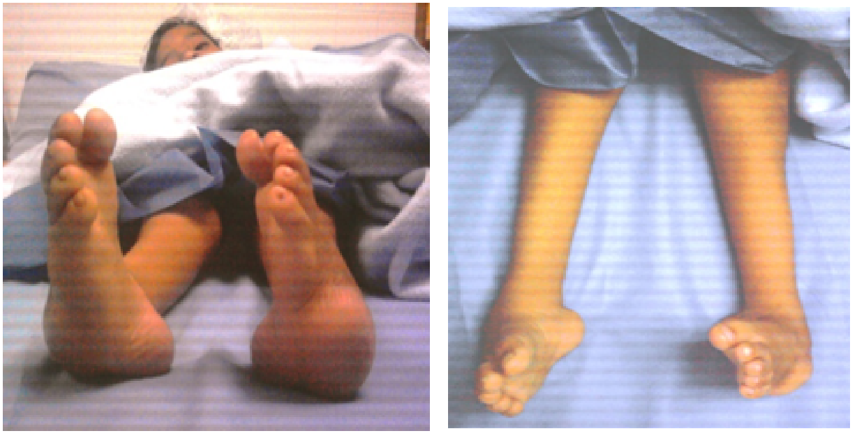 CIRUGIA ORTOPEDICA RECONSTRUCTIVA DE MIEMBROS INFERIORES * * * * C. O