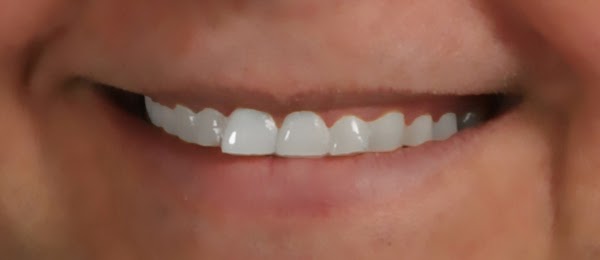 smile smile
