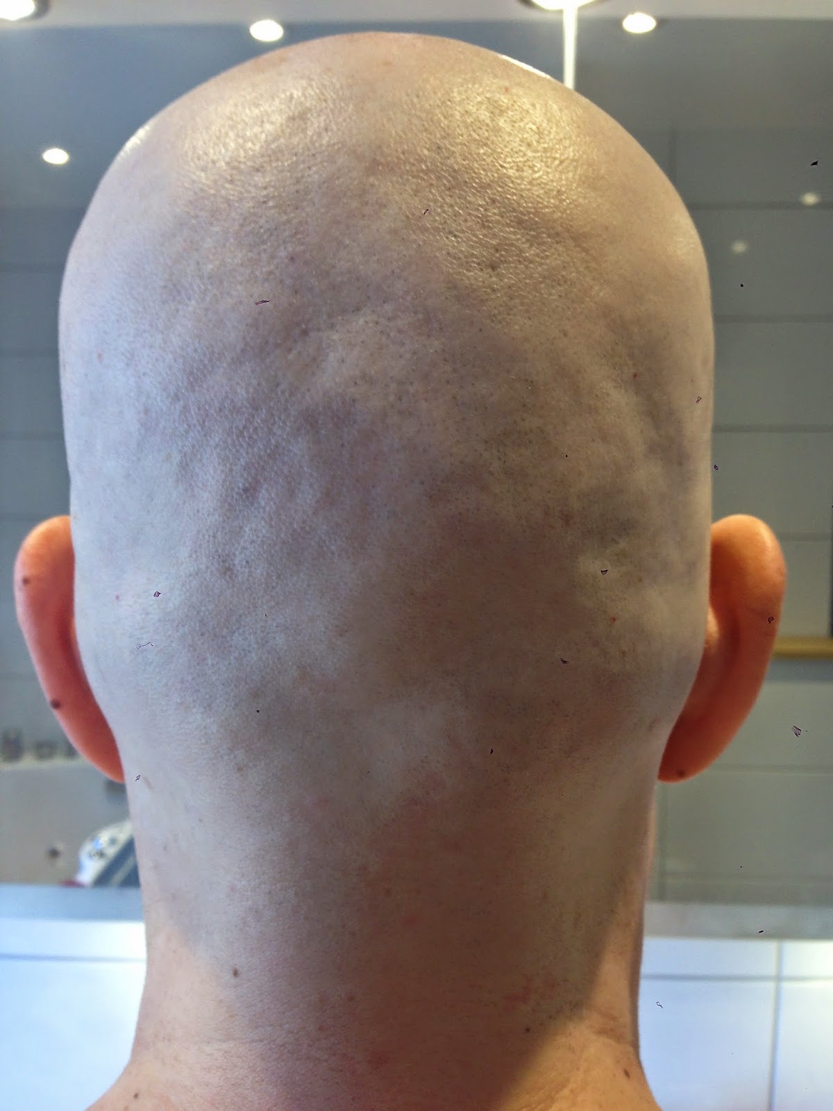 I'm a fighter! Finally a smooth bald head