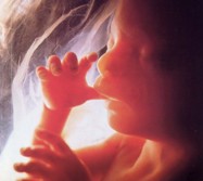 Módl się za zamordowane dzieci!