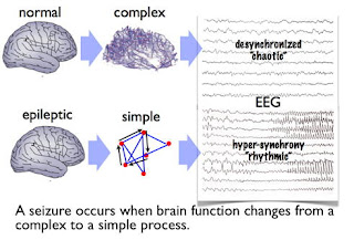 Penyakit Epilepsi Penyebab Gejala Pengobatan