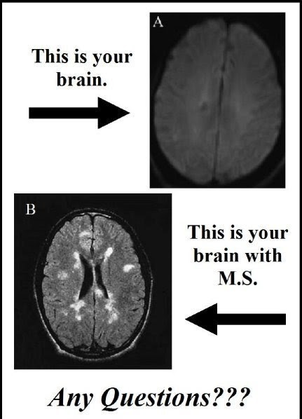 Watch When to See a Neurologist for MS video Watch When to See a Neurologist for MS video