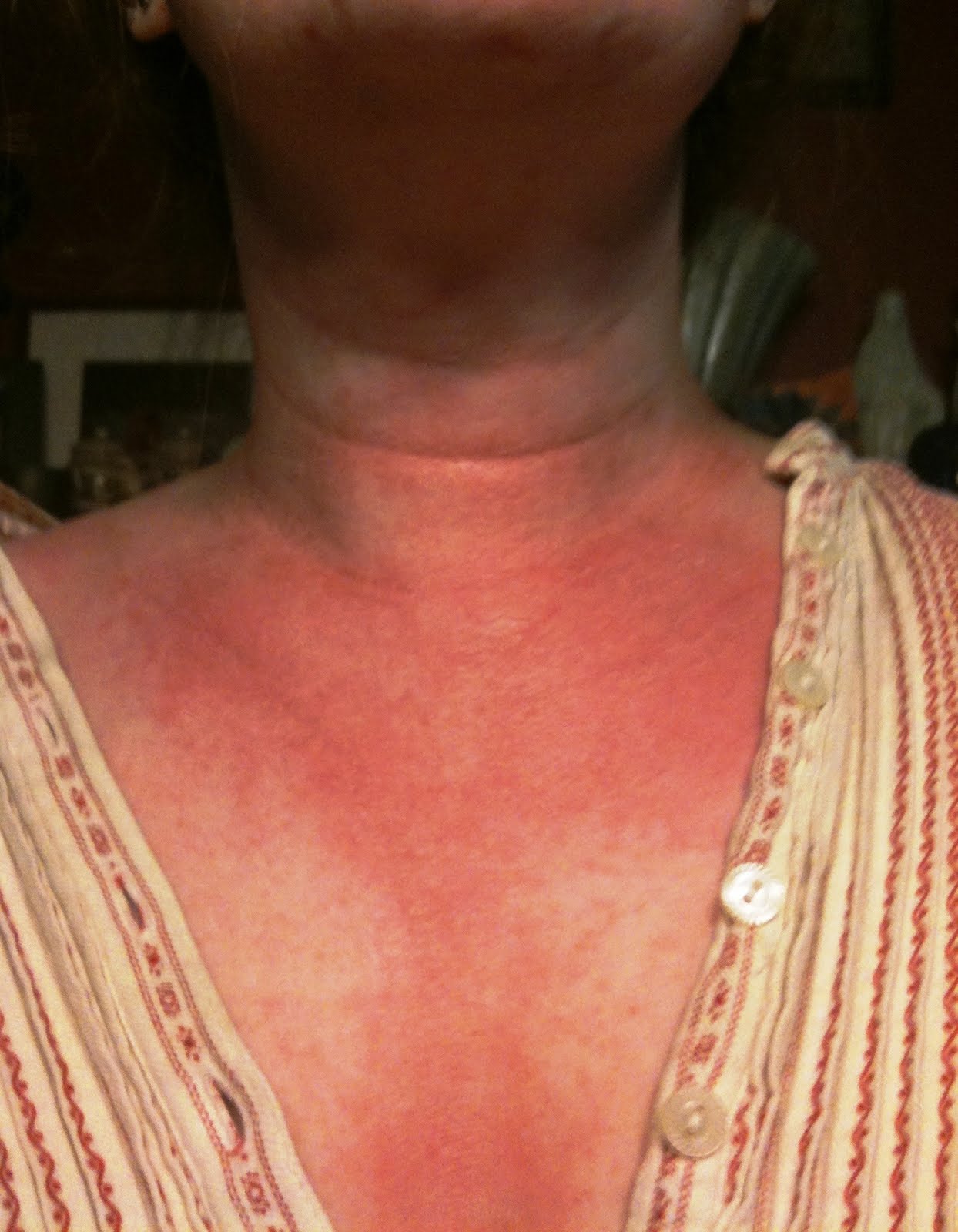 blahgblahgblahg O hai! Iz u my dokter?