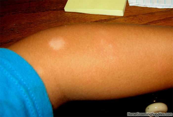 Simple Way To Get White Skin This is Skin pigmentation in Simple Way To Get White Skin This is Skin pigmentation in