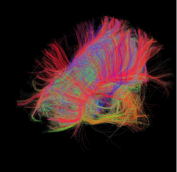 human connectome project