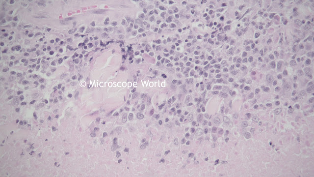 Microscopy image of tissue.