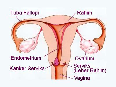 Kanker serviks