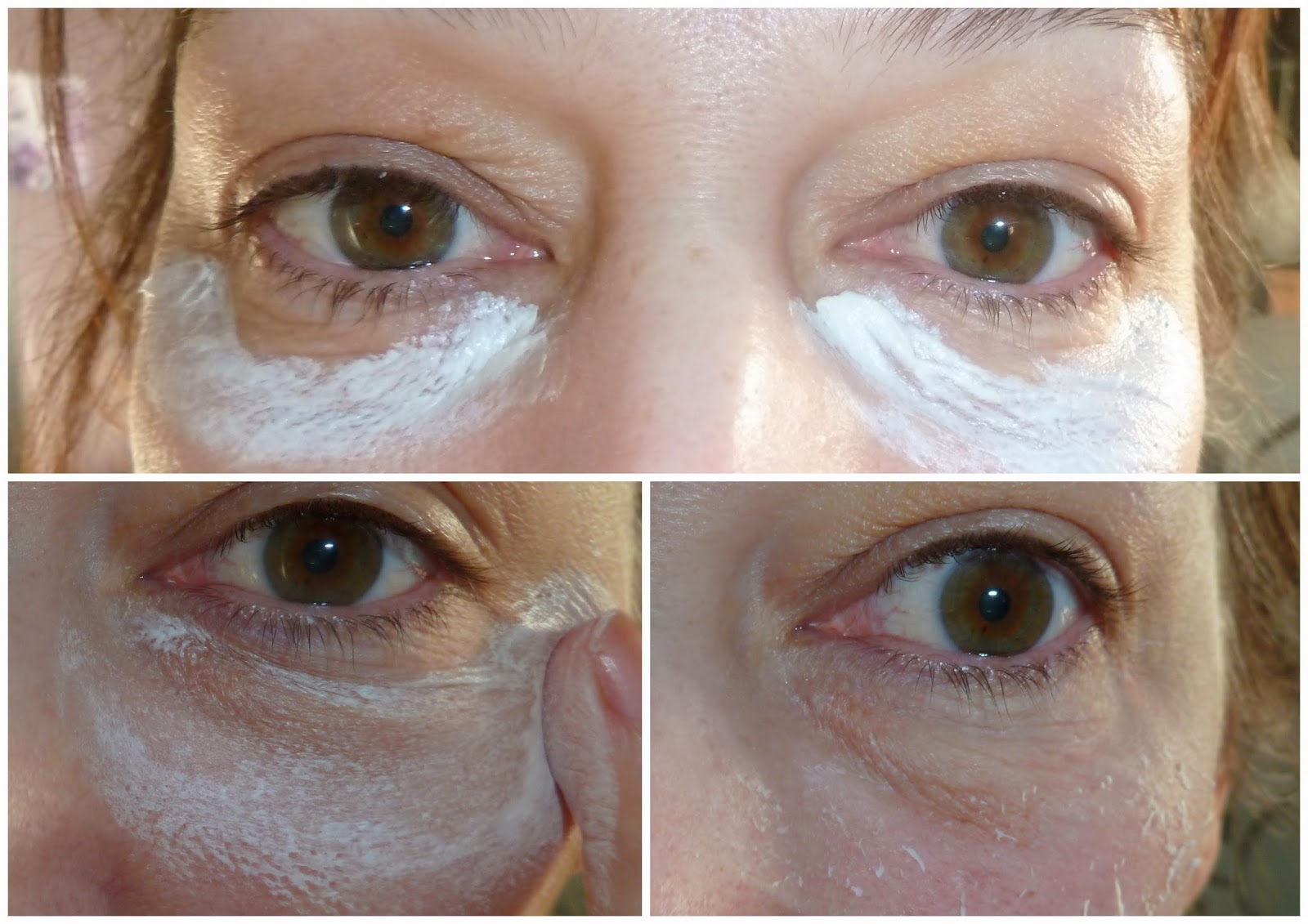 peeling rides sous les yeux peeling rides sous les yeux