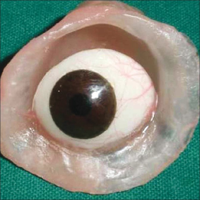 About Artificial Eyes