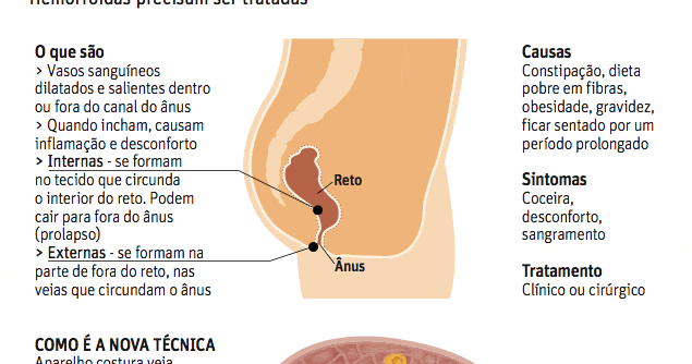 Drogas de um fungo de genitals de homens