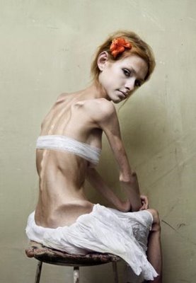 Essay on anorexia media